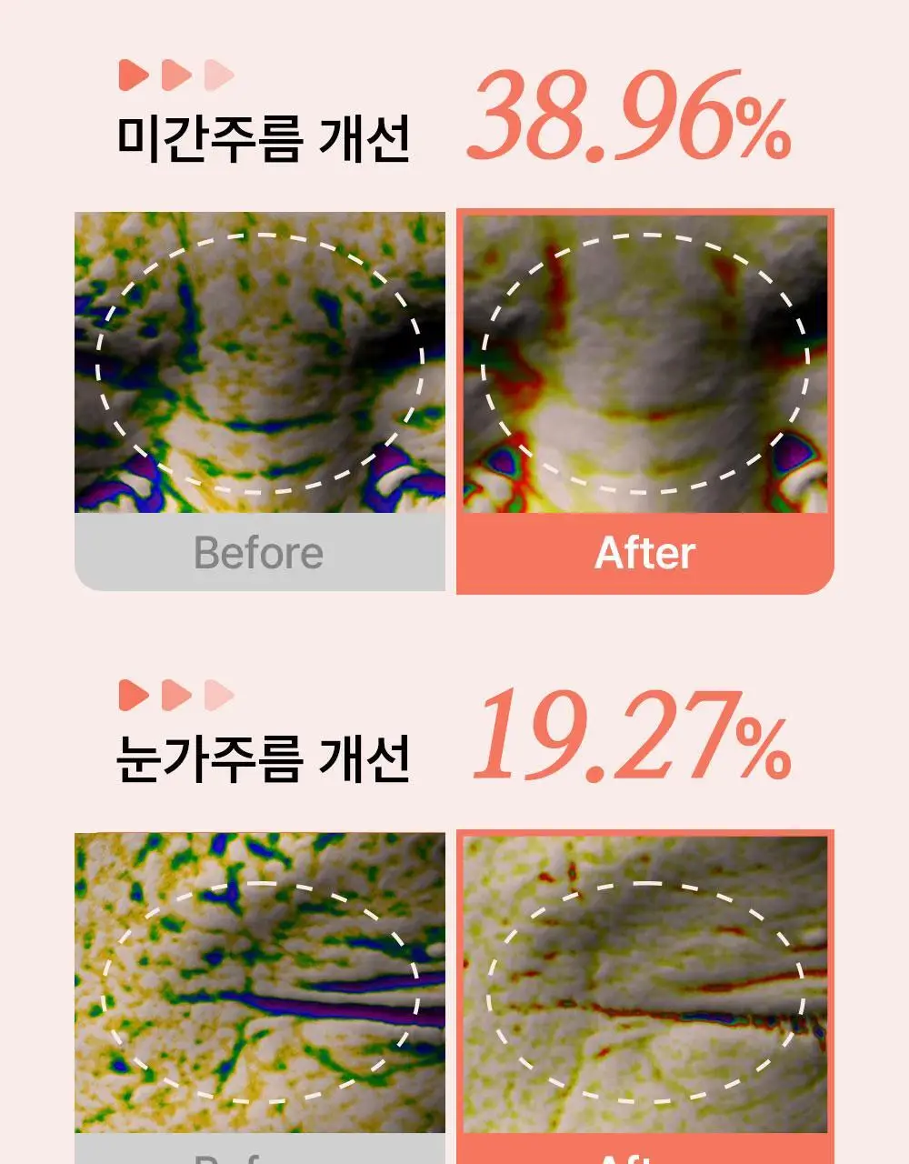 [주름패치]아크로패스 레티알엔 마이크로콘 패치 (미간/눈가팔자 중 택1) 상세페이지 2